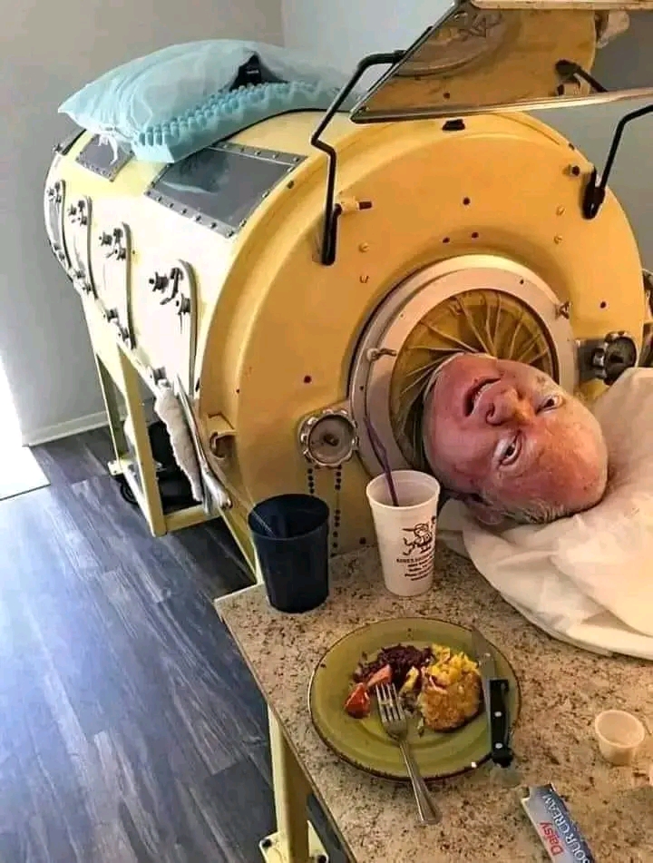 الأمريكي بول ألكسندر ( عمره 76 سنة ) أصيب بشلل الأطفال
