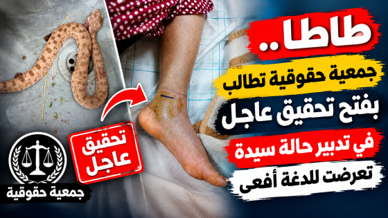 طاطا.. جمعية حقوقية تطالب بفتح تحقيق عاجل في تدبير حالة سيدة تعرضت للدغة أفعى
